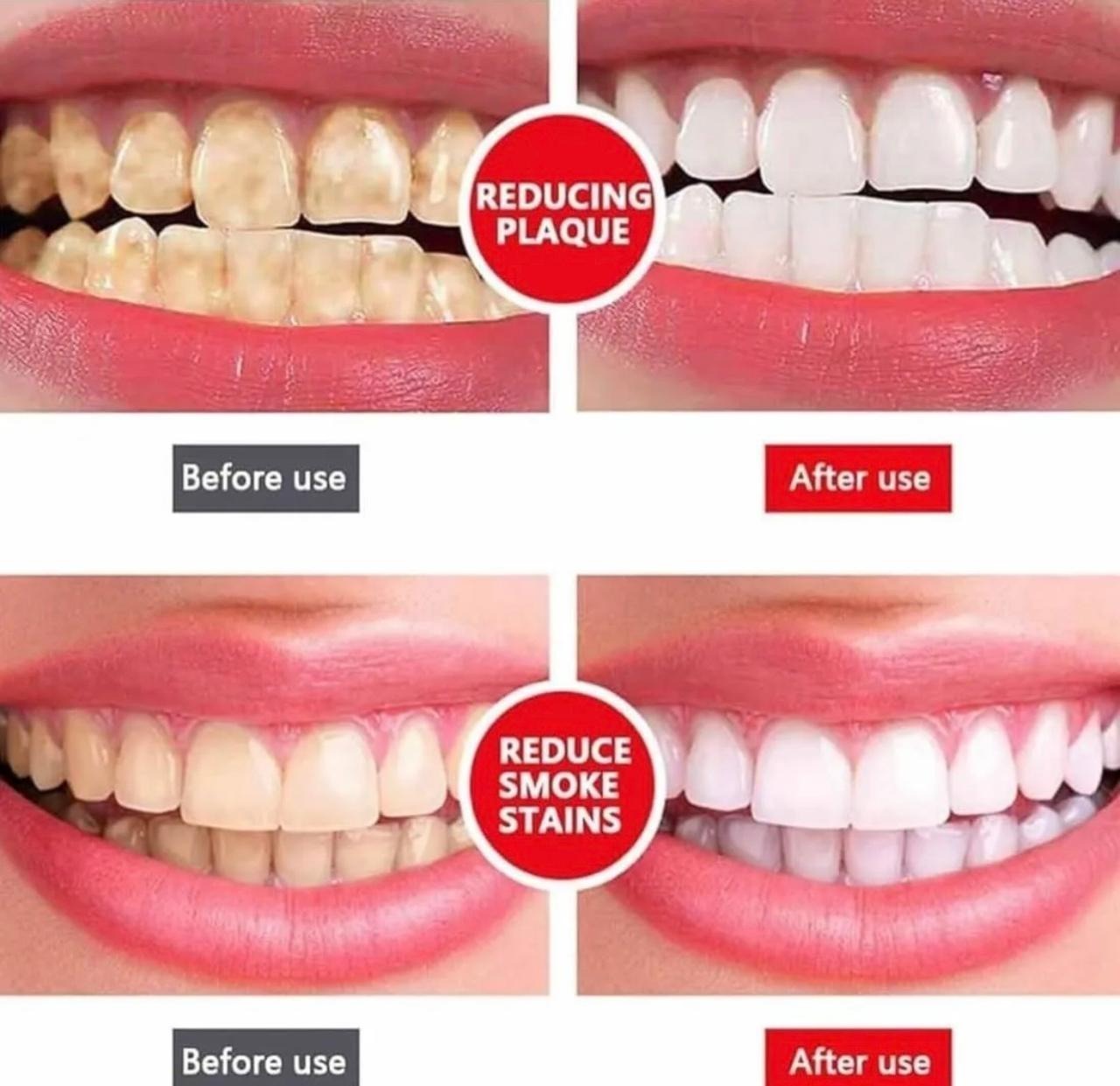 SP-4 Ultra Whitening Probiotic Toothpaste – Natural Teeth Whitening & Long Lasting Fresh Breath - Image 3