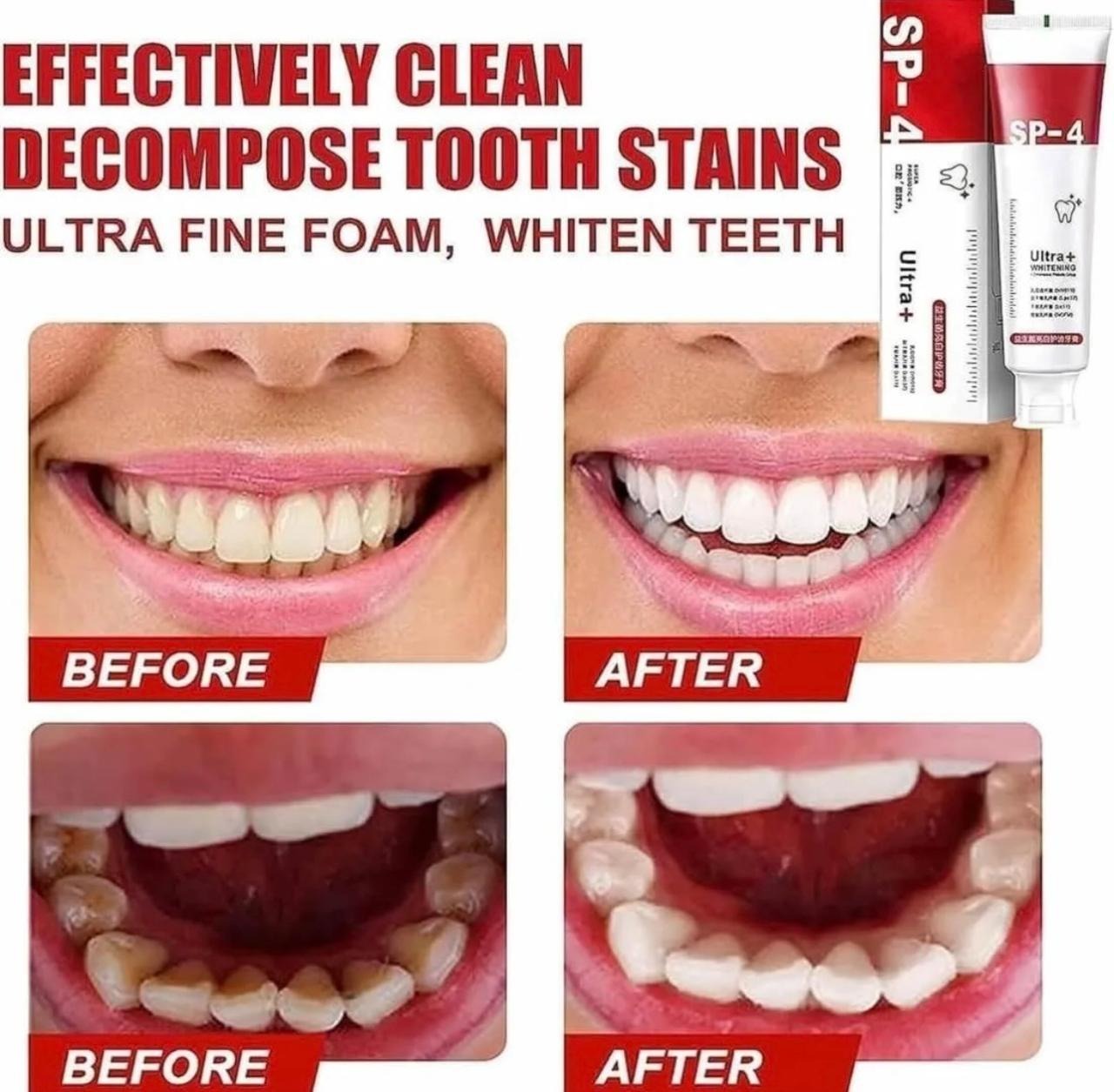 SP-4 Ultra Whitening Probiotic Toothpaste – Natural Teeth Whitening & Long Lasting Fresh Breath - Image 2